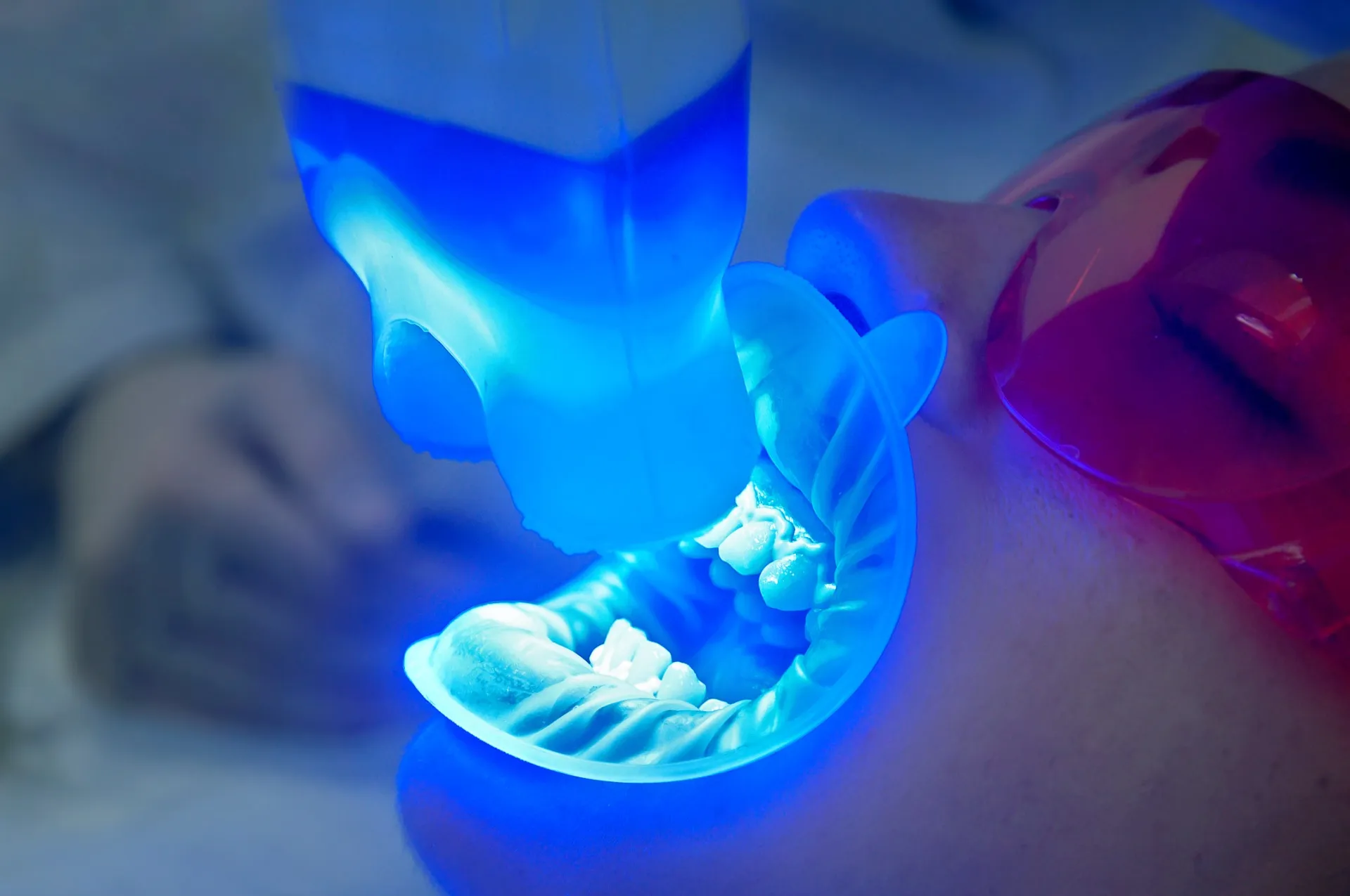 人気急上昇！ホワイトニング歯石除去の最新技術とは？