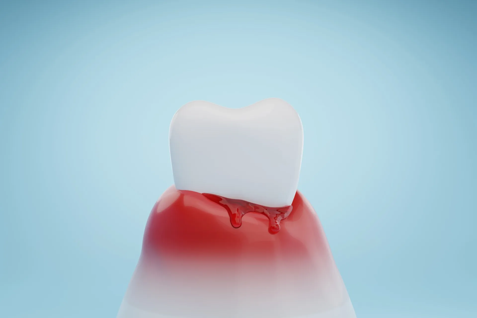 歯周病が引き起こす全身疾患とその予防法