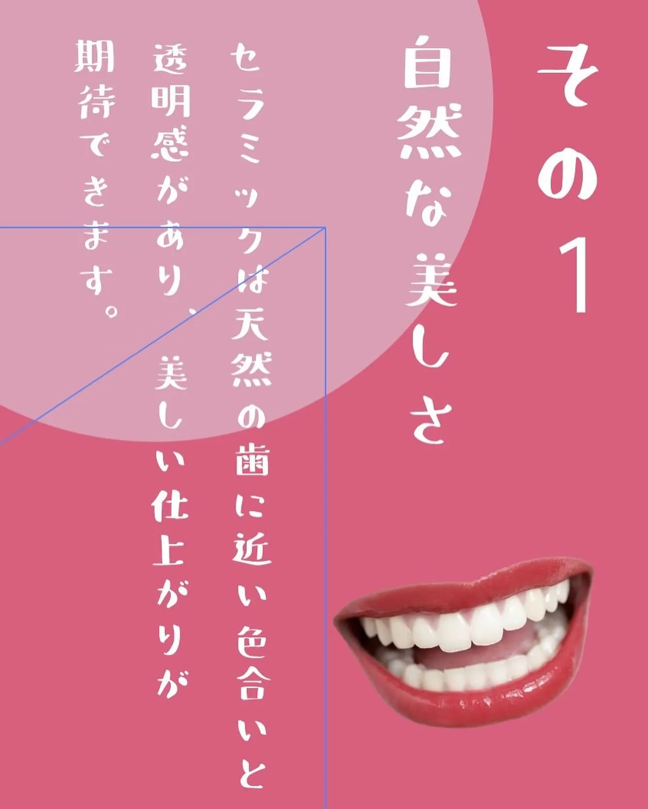 美しい歯があるのが当たり前の社会を作りたい🎵